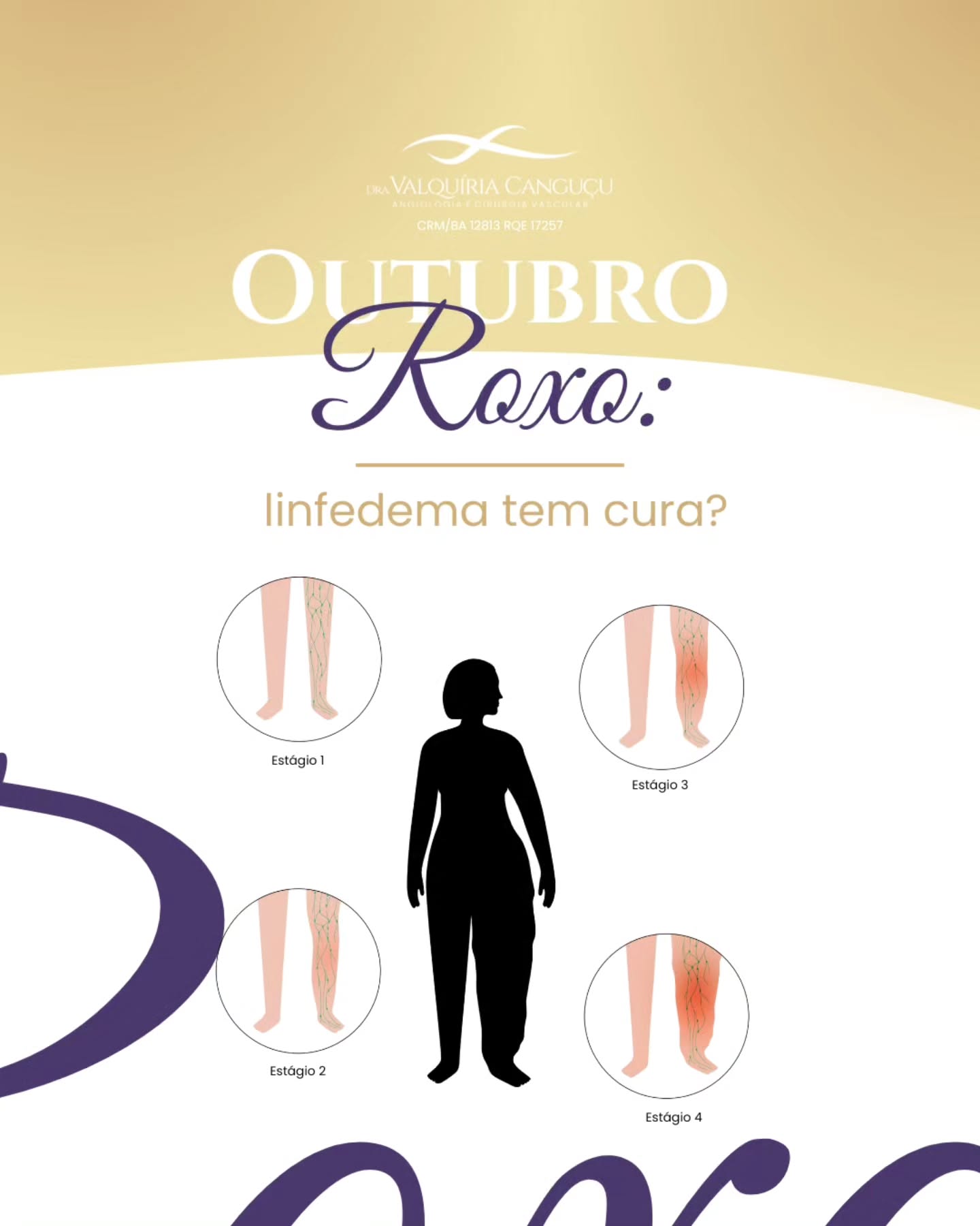 Você sabe o que é o linfedema e por que ele merece tanta atenção neste Outubro Roxo?