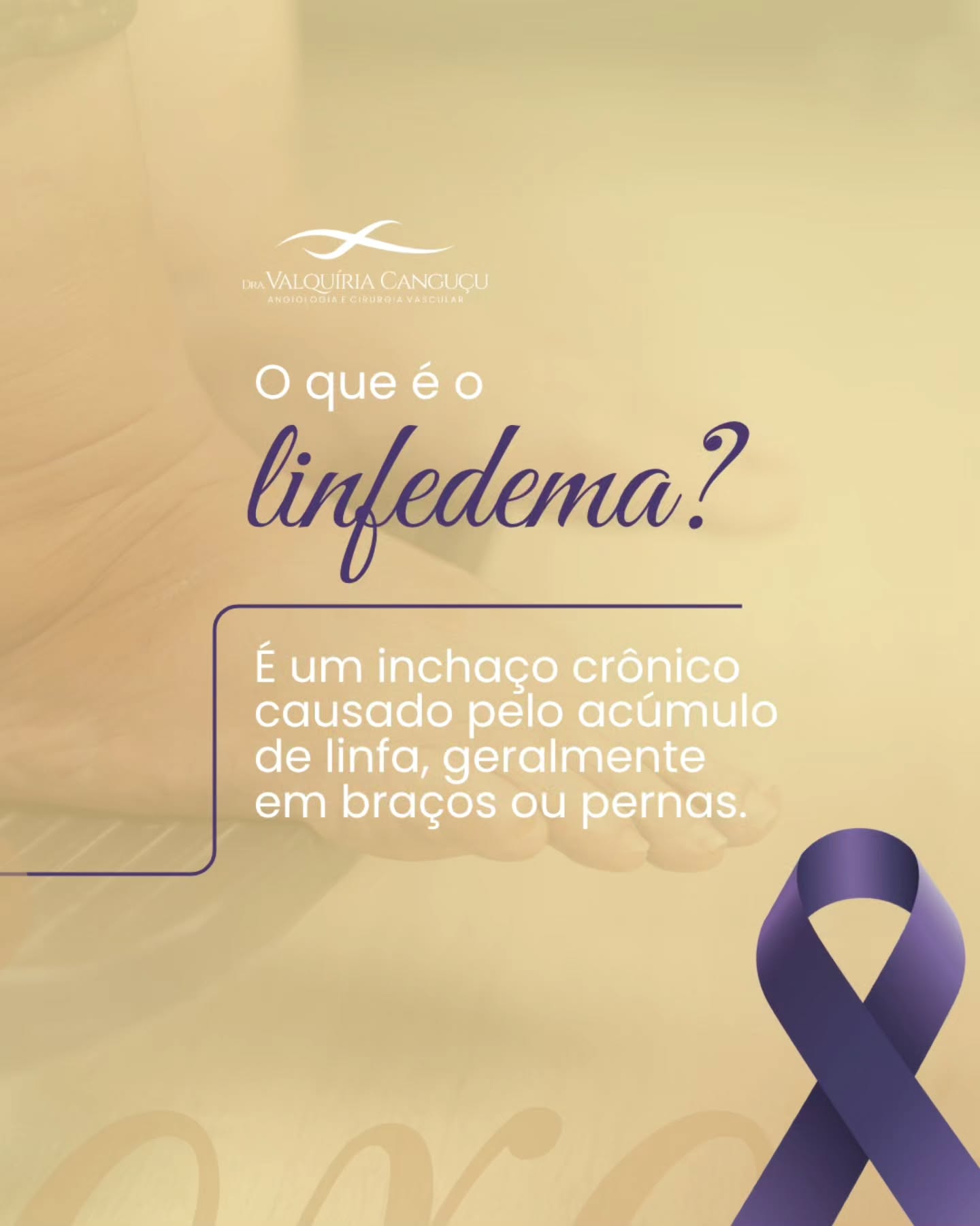 Você sabe o que é o linfedema e por que ele merece tanta atenção neste Outubro Roxo?