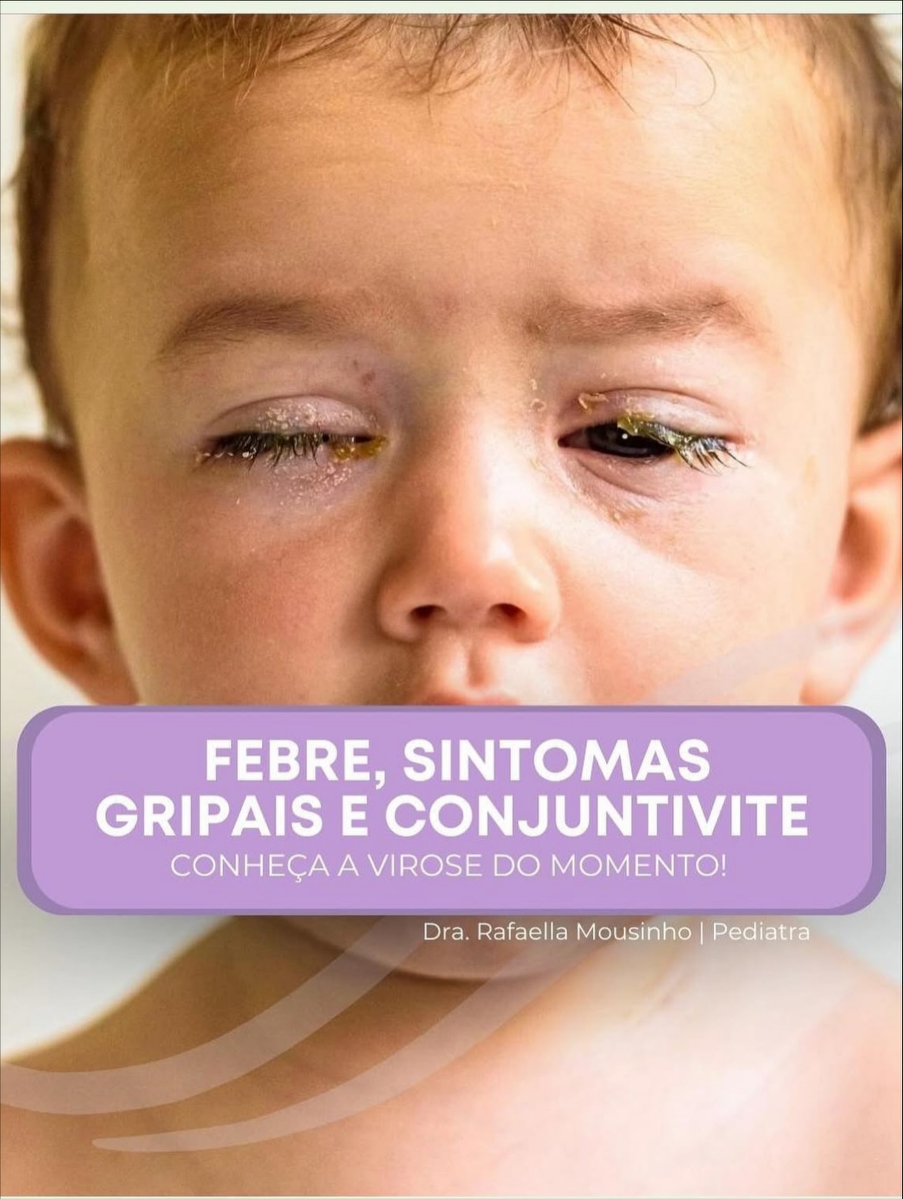 A virose do momento é essa: sintomas gripais e conjuntivite.