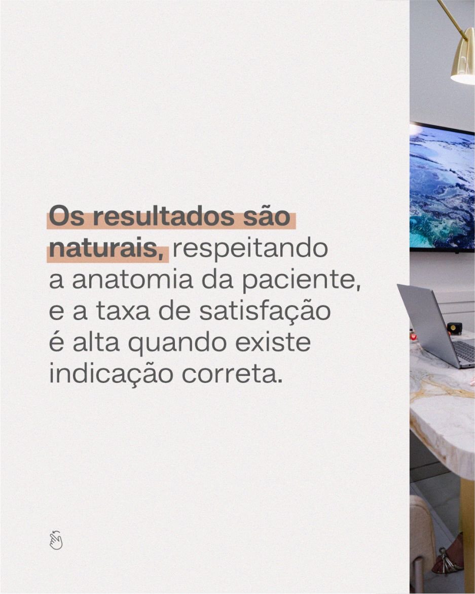 A verdade sobre a Ninfoplastia