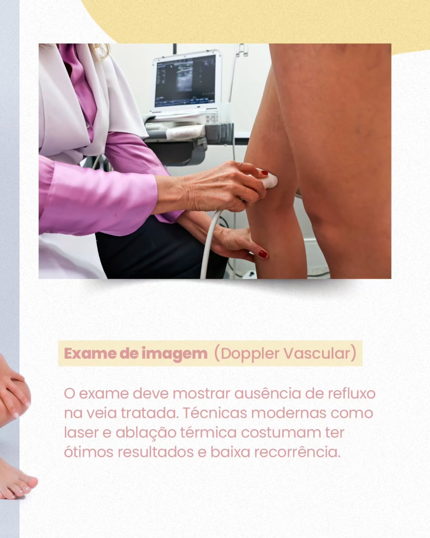 Você já parou para perceber se o seu tratamento de varizes realmente está fazendo diferença no seu dia a dia?