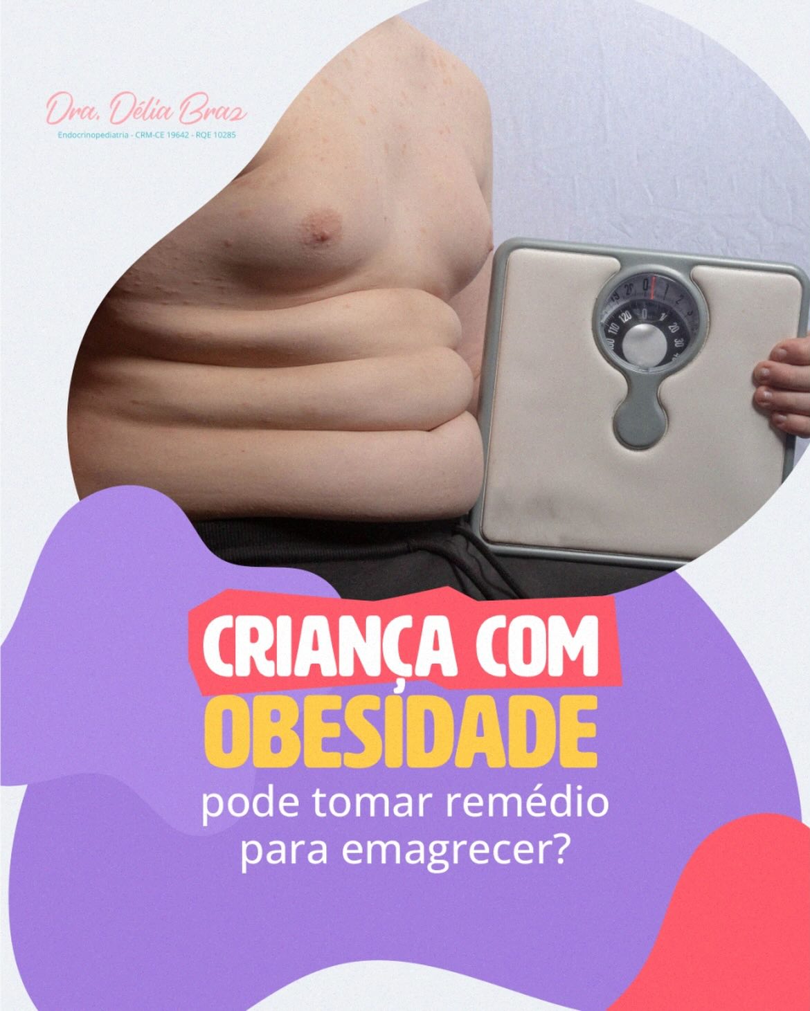 Criança com obesidade