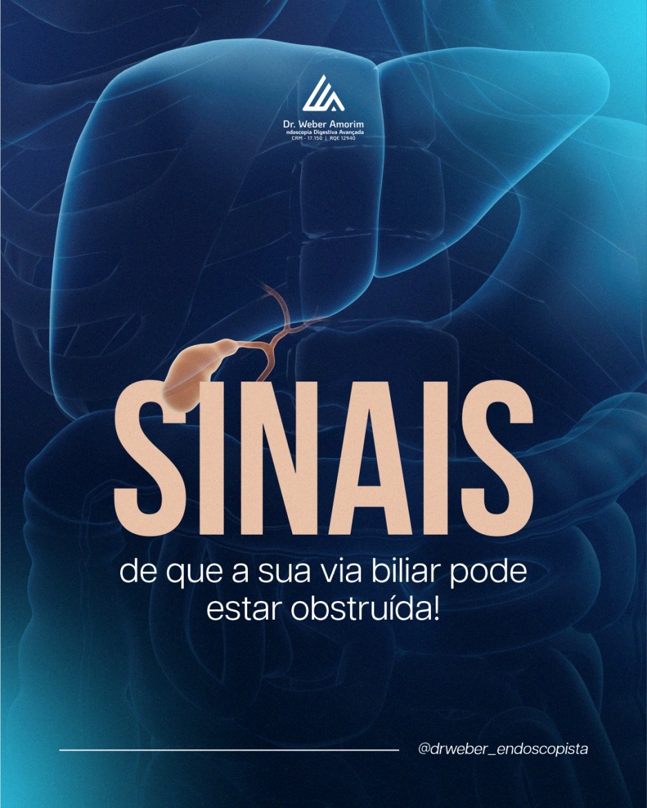 Sinais que sua via biliar pode estar obstruída