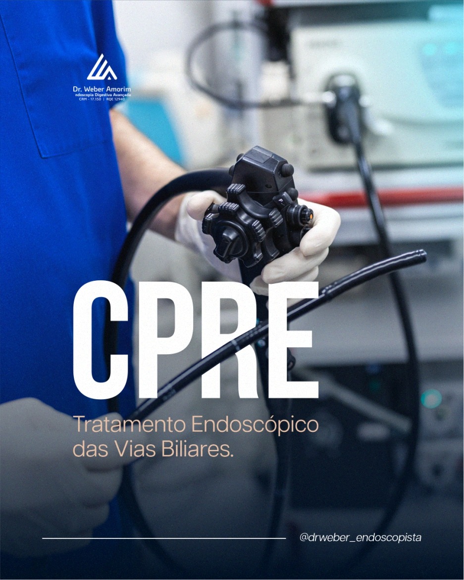 Para que serve a CPRE?