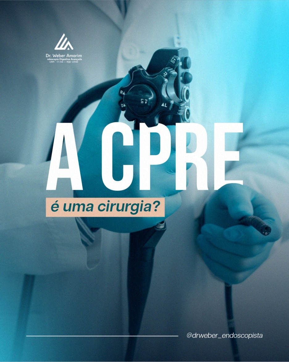 CPRE procedimento endoscópico
