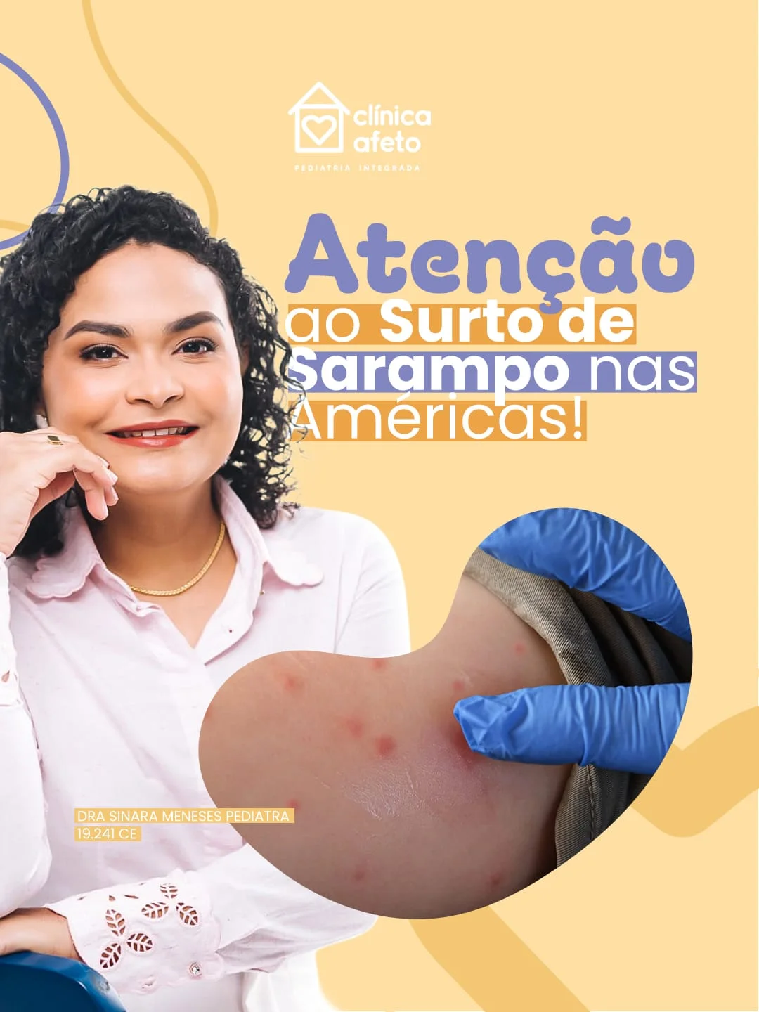 Atenção ao Surto de Sarampo nas Américas
