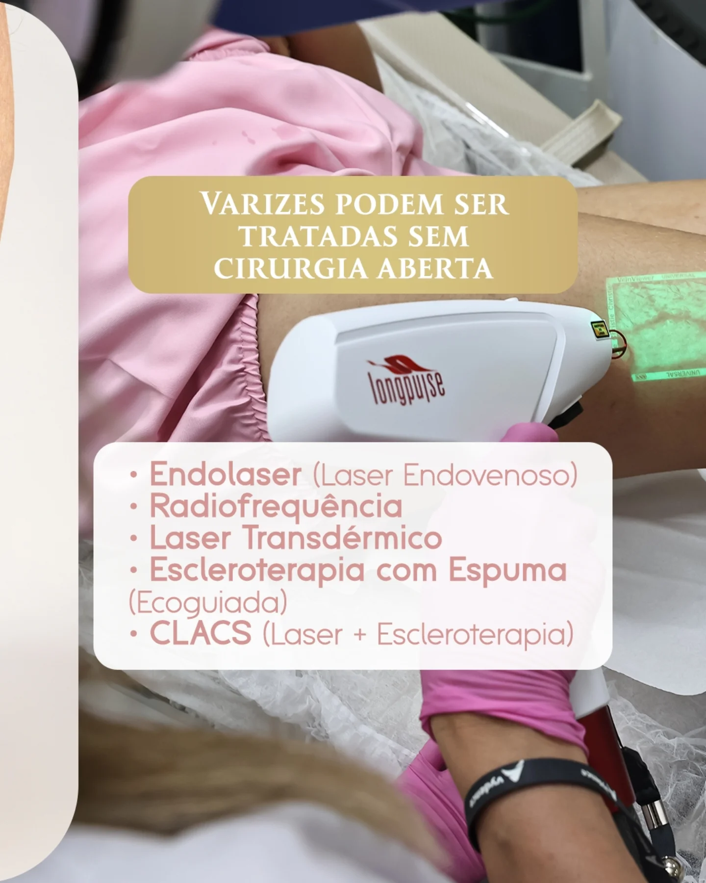 Você acha que já sabe tudo sobre varizes?