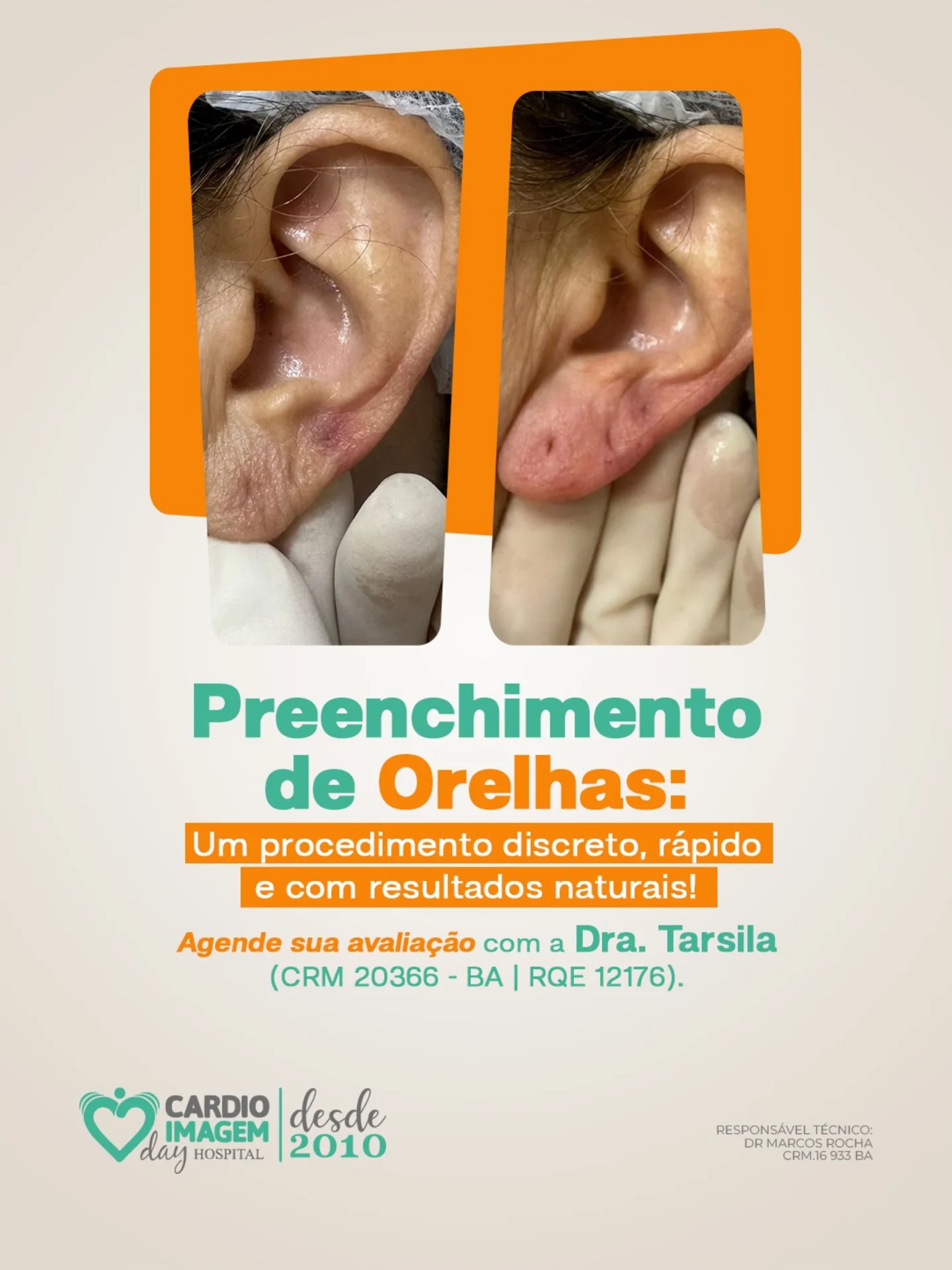 Você sabia que o envelhecimento também acontece nas orelhas?