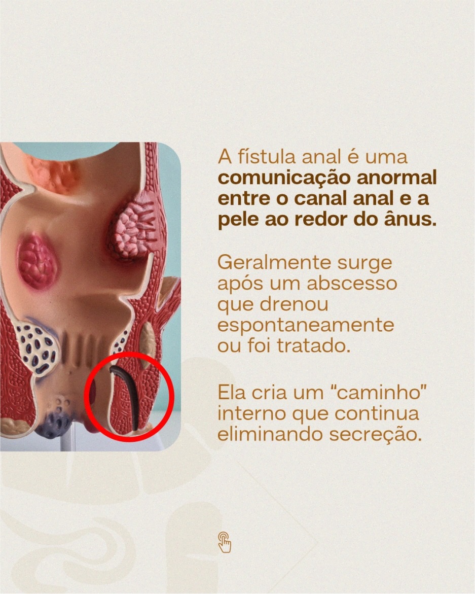 Se você já percebeu secreção recorrente na região anal, não ignore esse sinal!