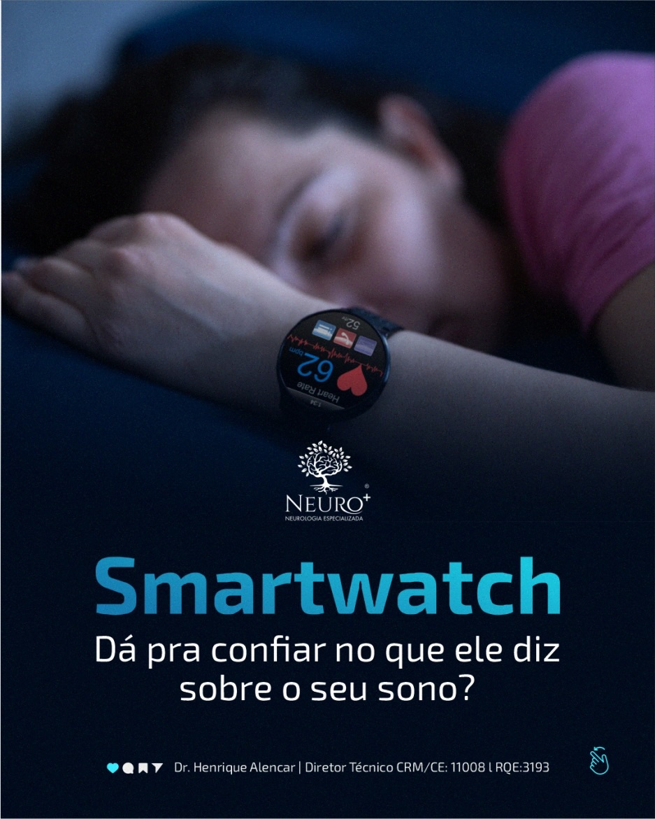 Você costuma acompanhar seu sono pelo Smartwatch?