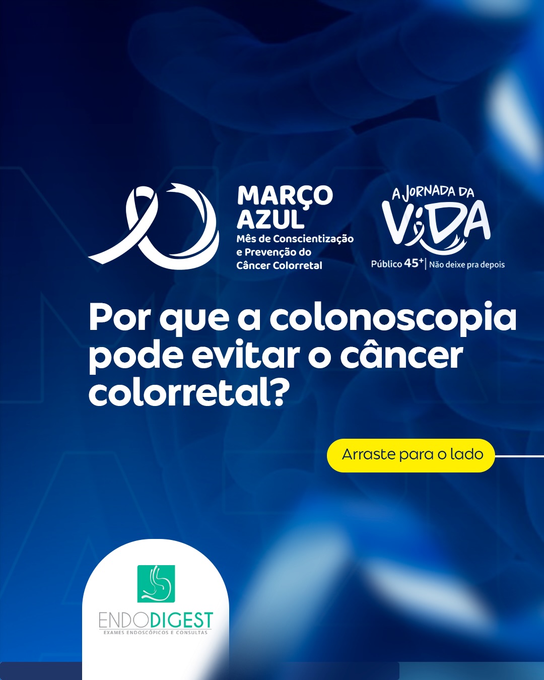 Porque a colonoscopia pode evitar o câncer colorretal?