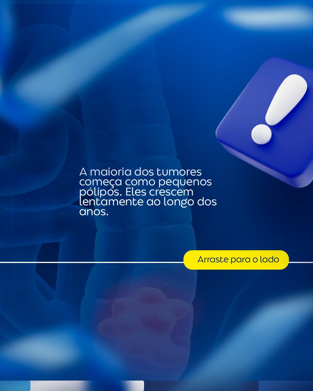 Porque a colonoscopia pode evitar o câncer colorretal?