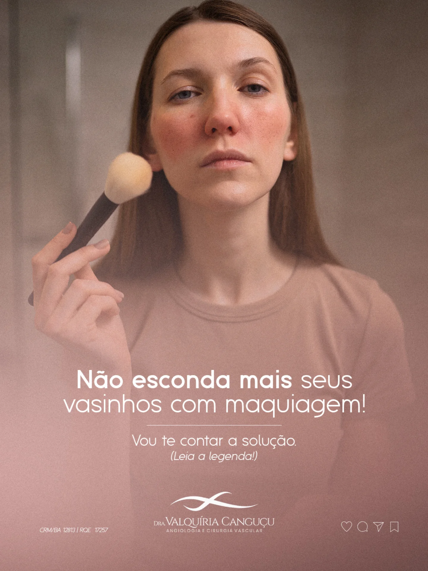 Não esconda mais seus vasinhos com maquiagem!