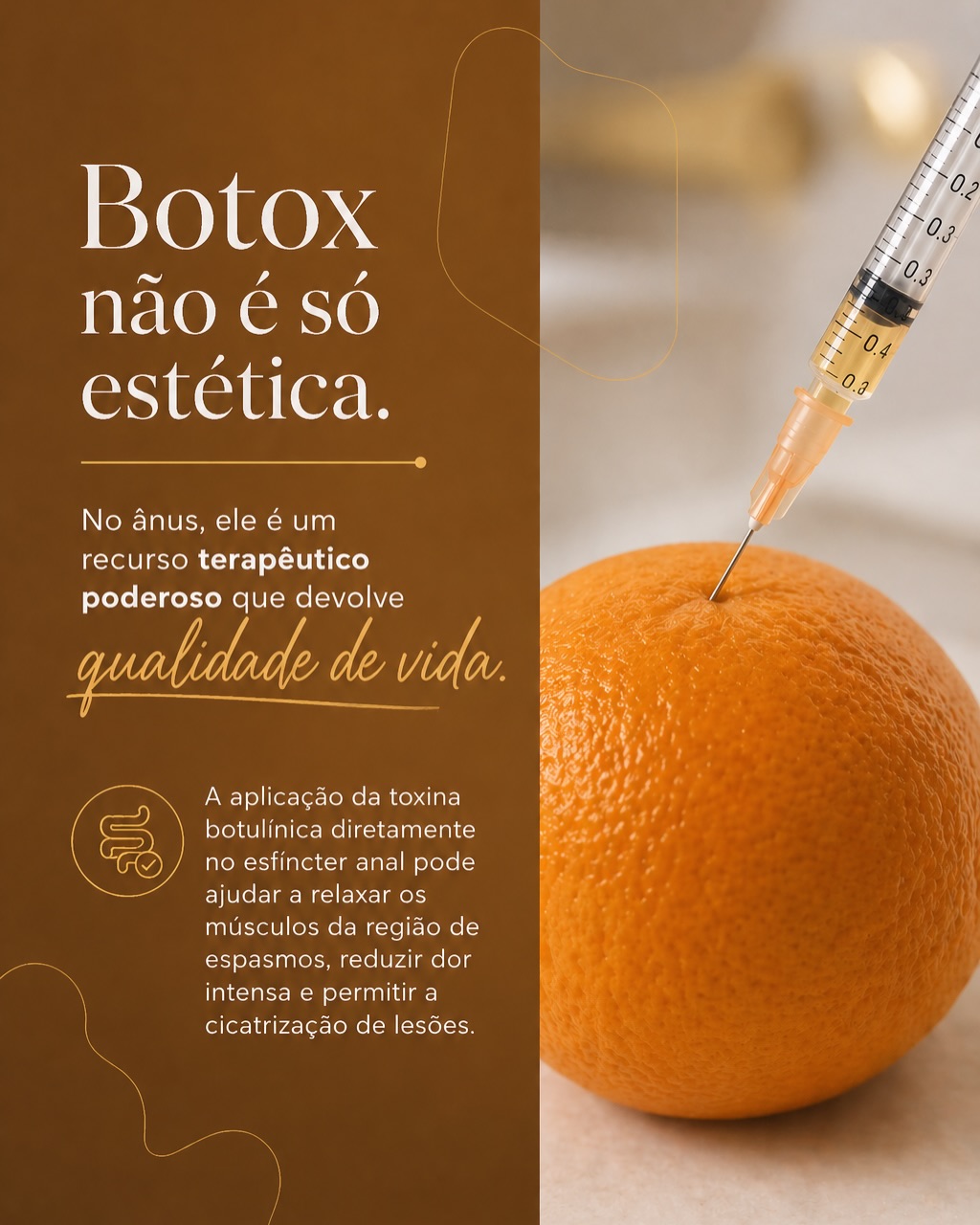 Verdades importantes sobre  botox anal