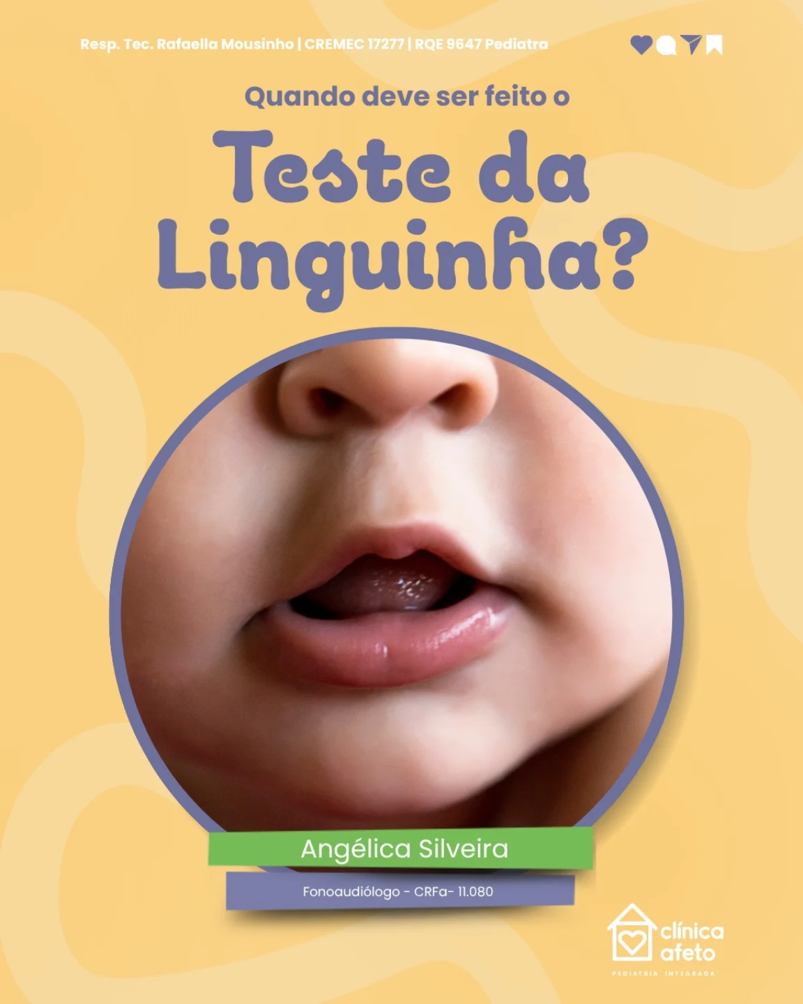 Teste da linguinha!