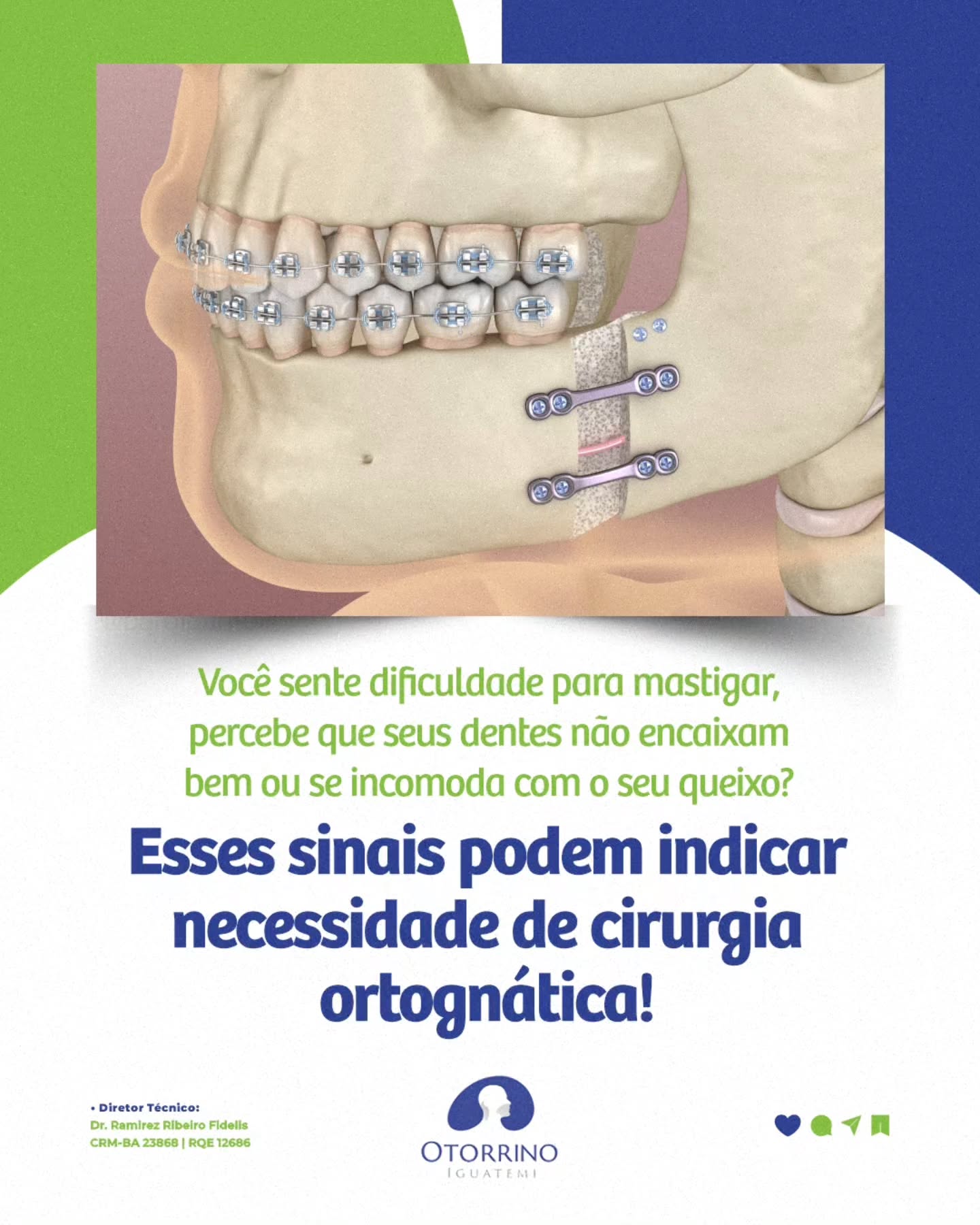 Aqui na Otorrino Iguatemi, você pode fazer uma avaliação completa para entender o seu caso e descobrir o melhor tratamento para você