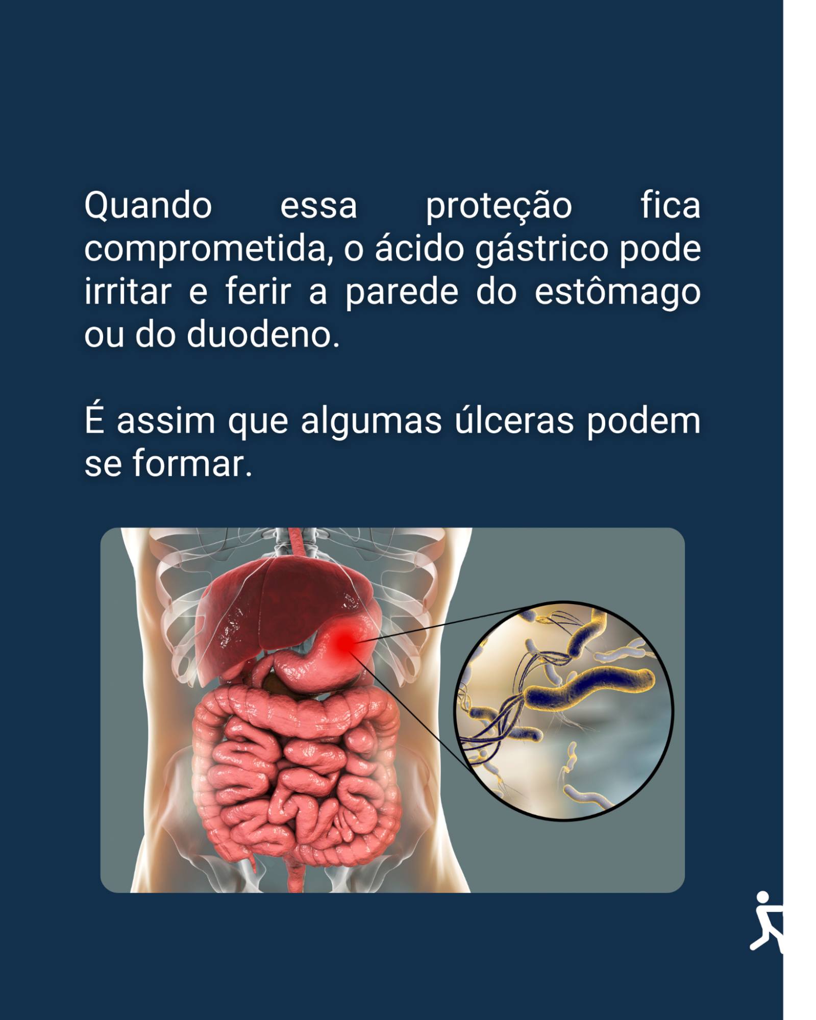 Entender a relação entre H. pylori e úlcera ajuda a perceber por que alguns sintomas nunca devem ser ignorados.