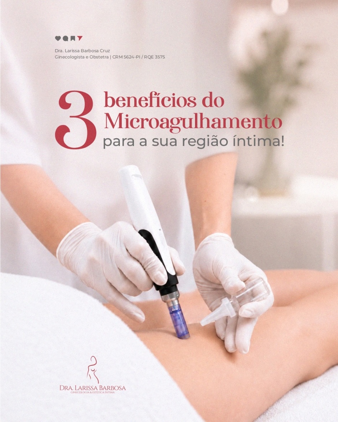 3 Benefícios do microagulhamento para sua região íntima