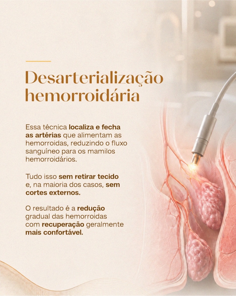 Nem toda cirurgia para hemorroida é igual.