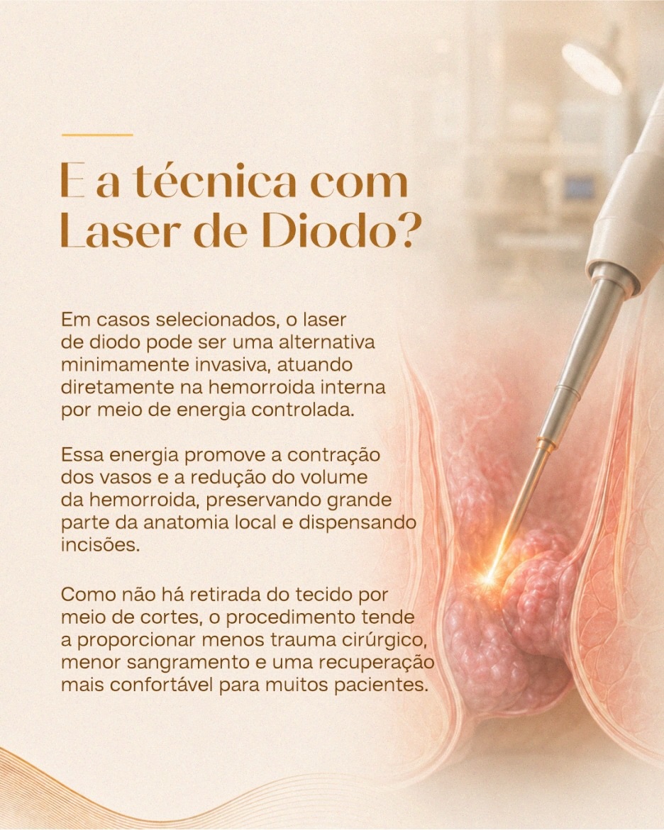 Nem toda cirurgia para hemorroida é igual.