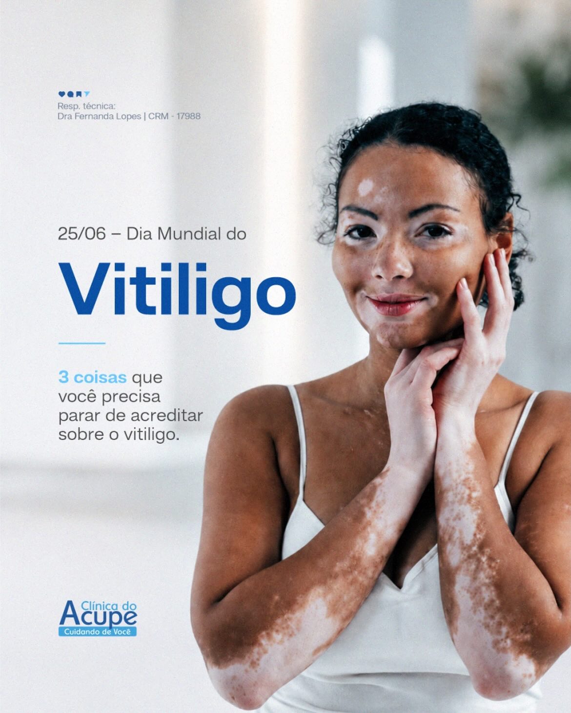 25/06 Dia Mundial do Vitiligo -  3 coisas que você precisa parar de acreditar sobre o vitiligo.