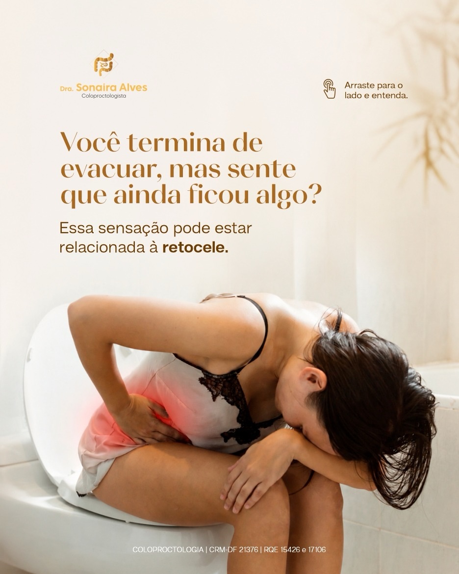 O que  retocele?