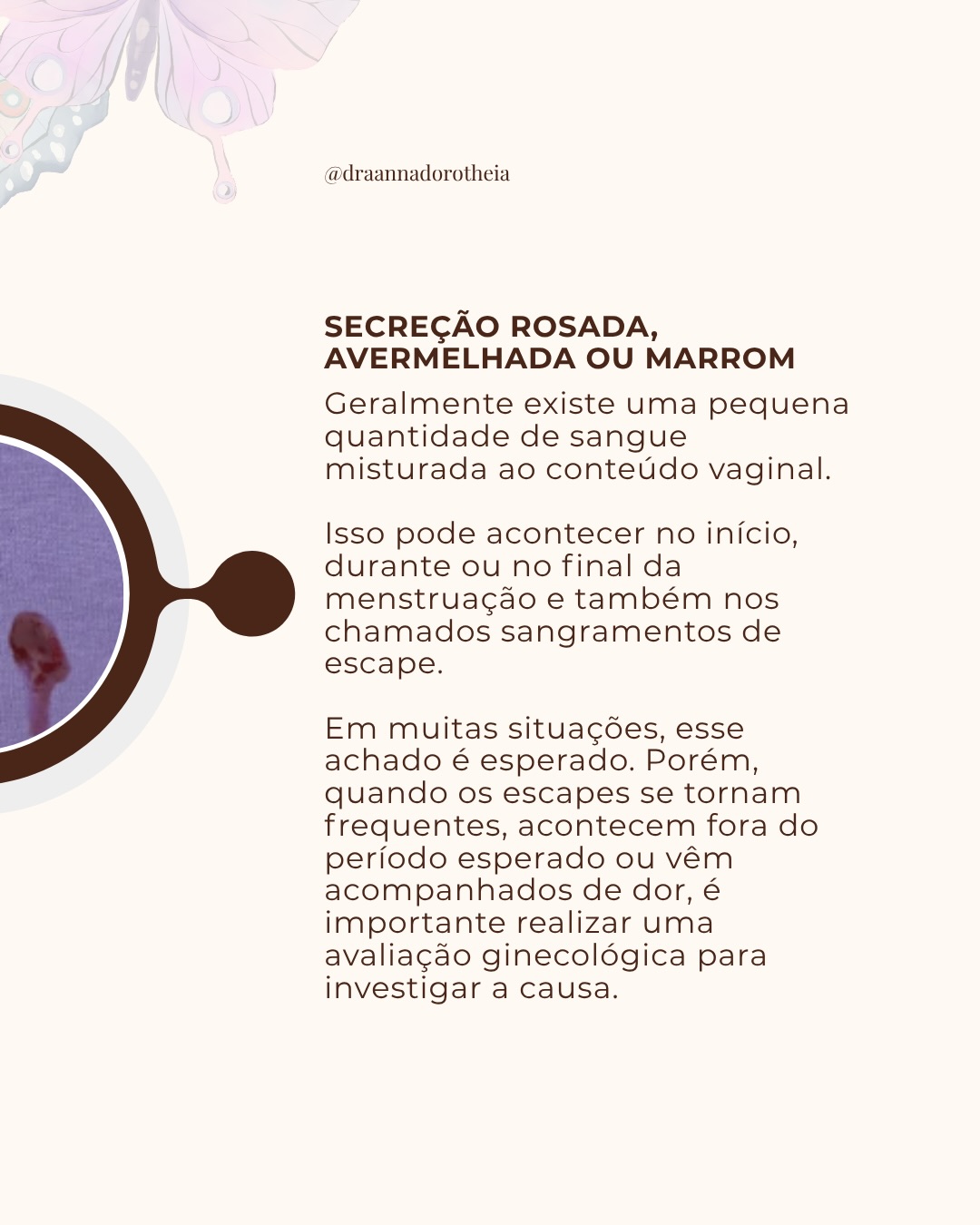 Seu guia definitivo das secreções íntimas