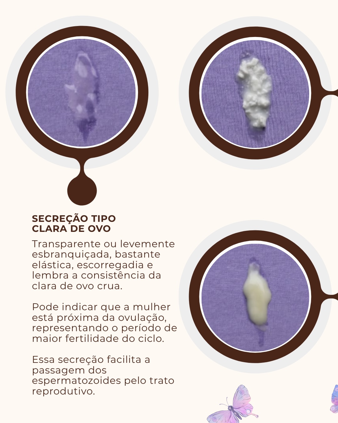 Seu guia definitivo das secreções íntimas