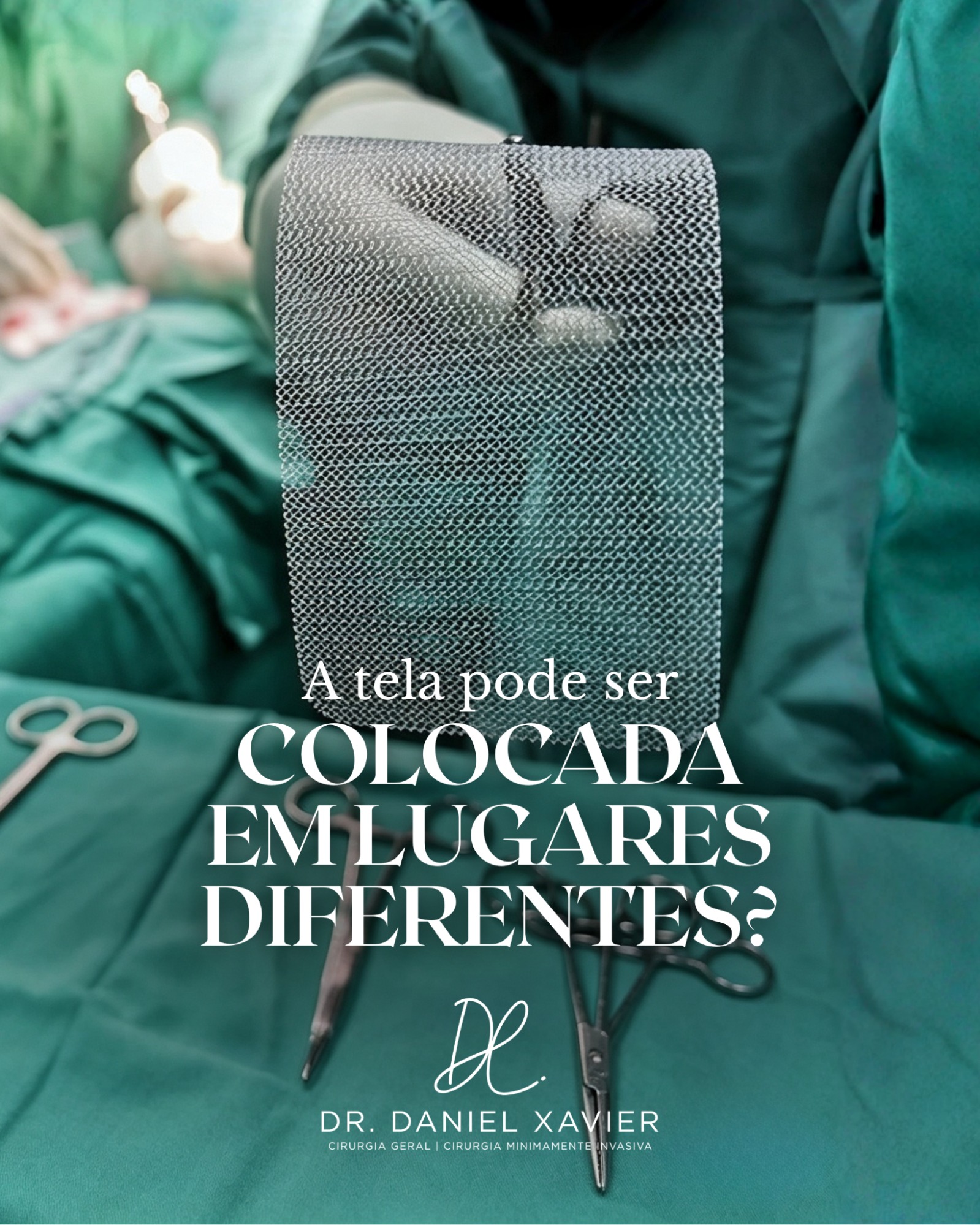 A tela pode ser colocada em lugares diferente?