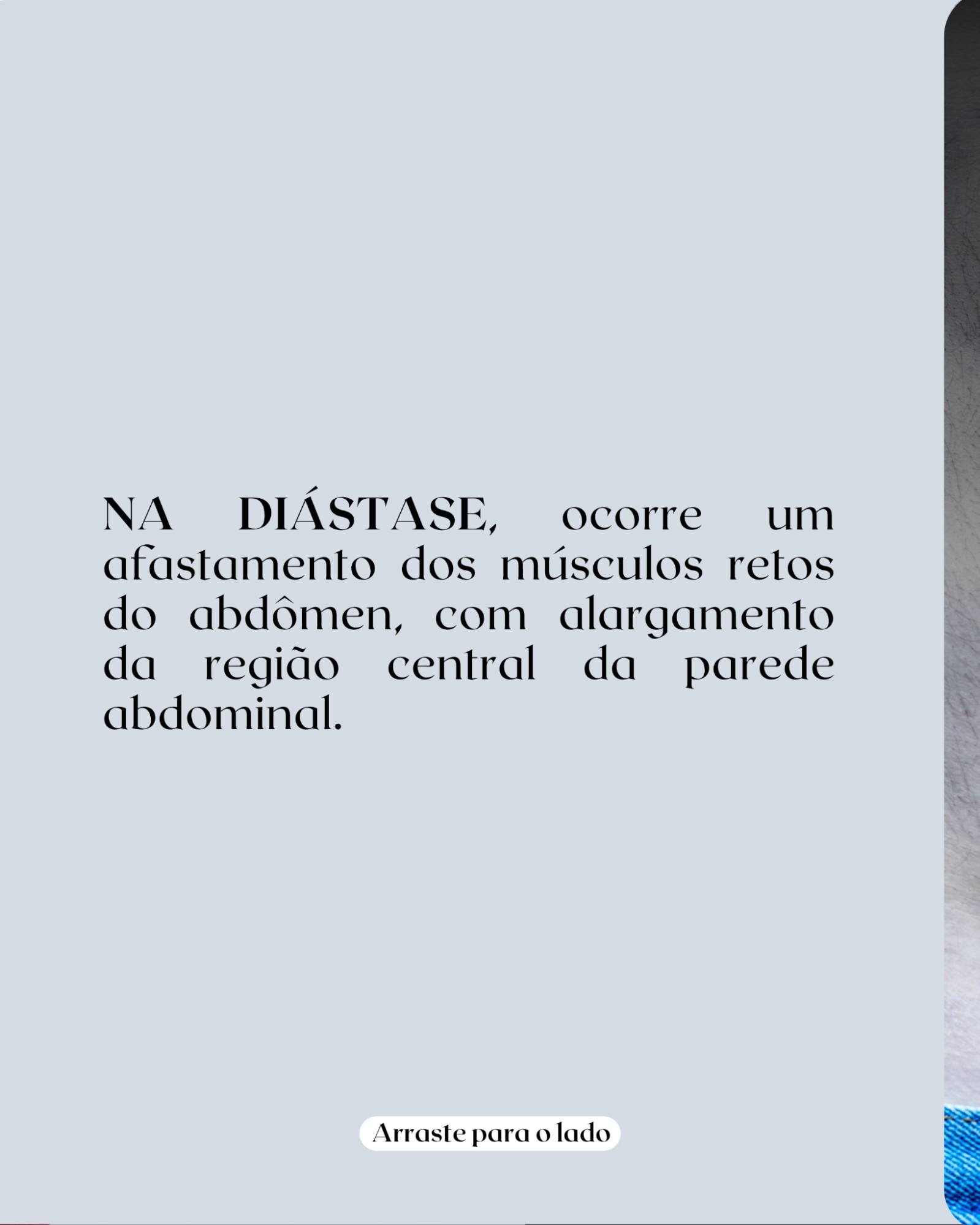 Você percebe um abaulamento no abdômen e pensa: “é hérnia”.