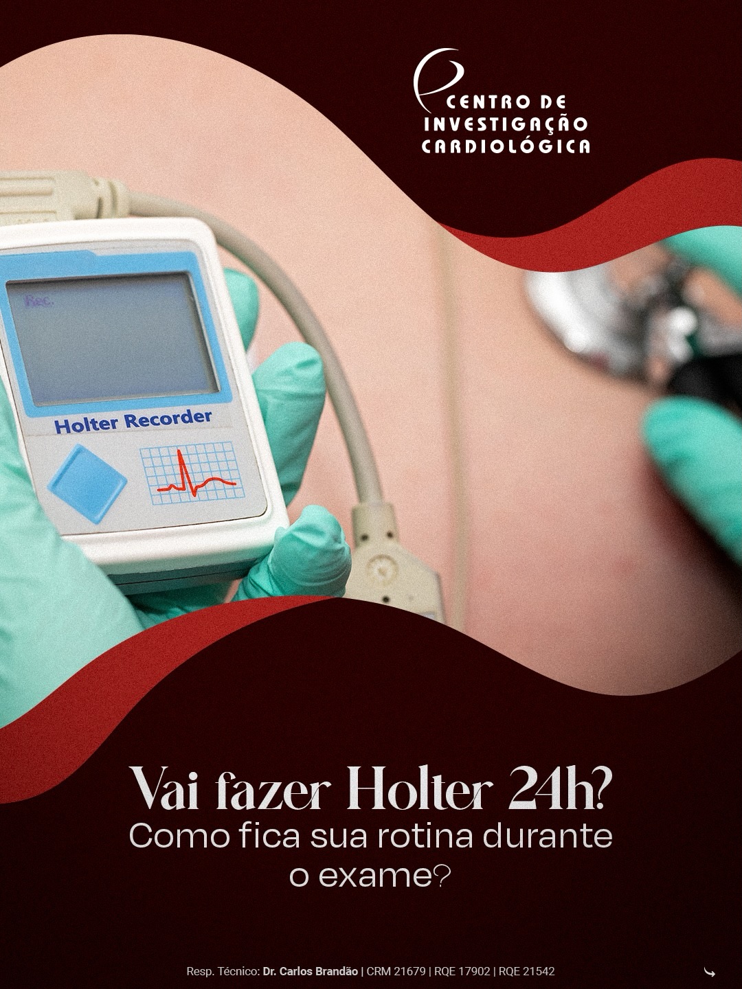 24 horas podem revelar informações que poucos minutos de exame não conseguem registrar.