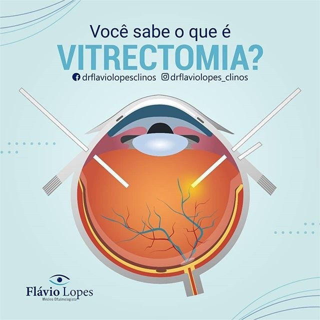 Fique bem informado  com as informações do Dr. Flavio Lopes!
