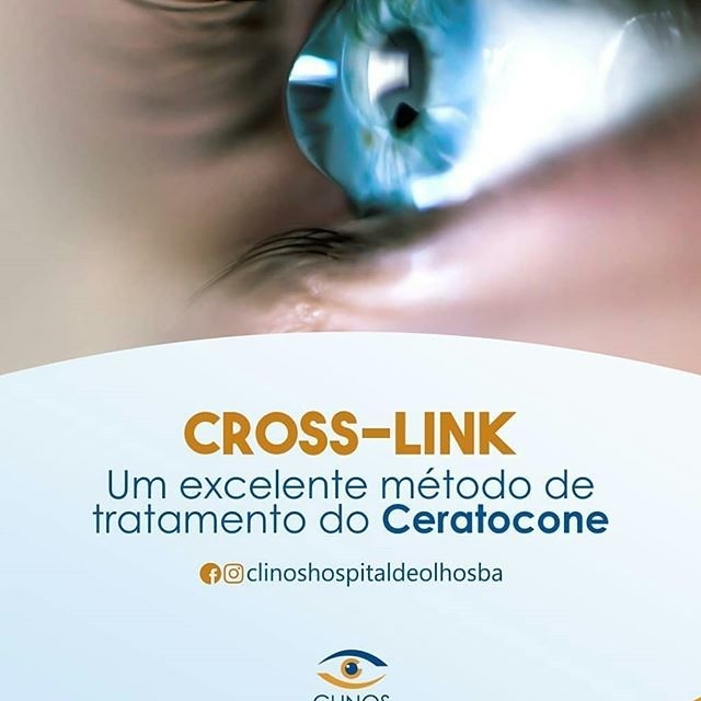 Dr. Flávio Lopes sempre pensando na saúde dos seus olhos!