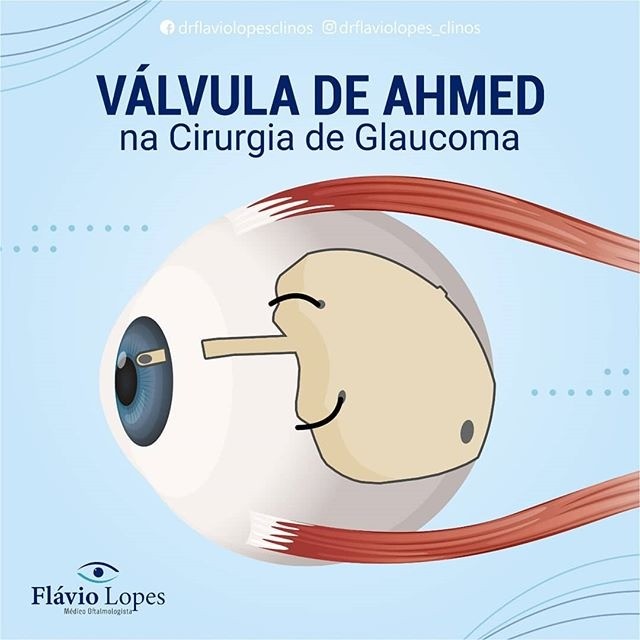 Conheça esse novo método de tratamento agendando uma consulta com o Dr. Flávio Lopes!