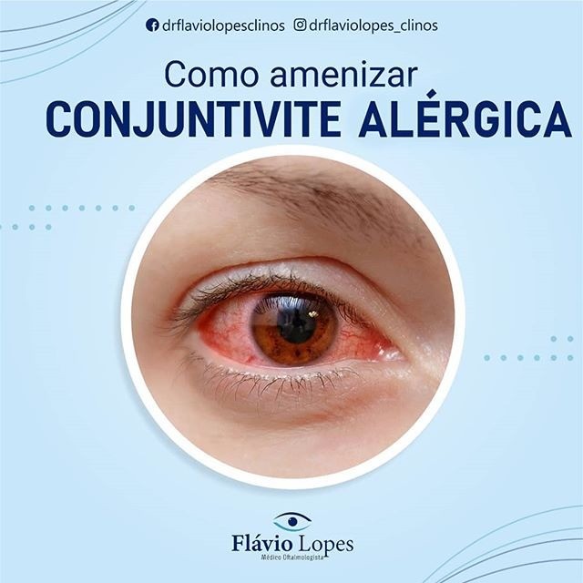 Agende seu atendimento com o Dr. Flávio Lopes!