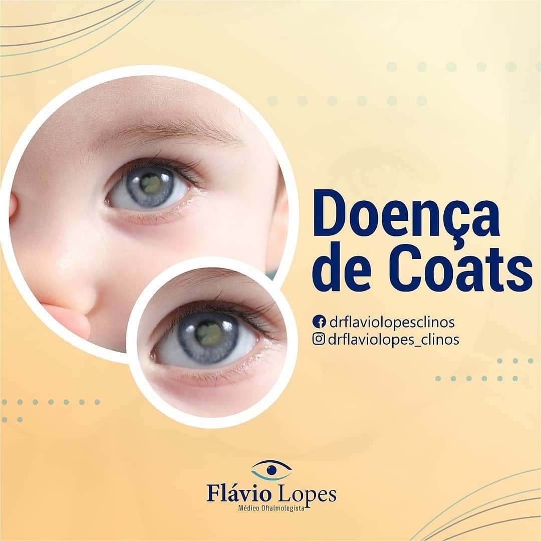 Você sabe oque é doença de Coats?