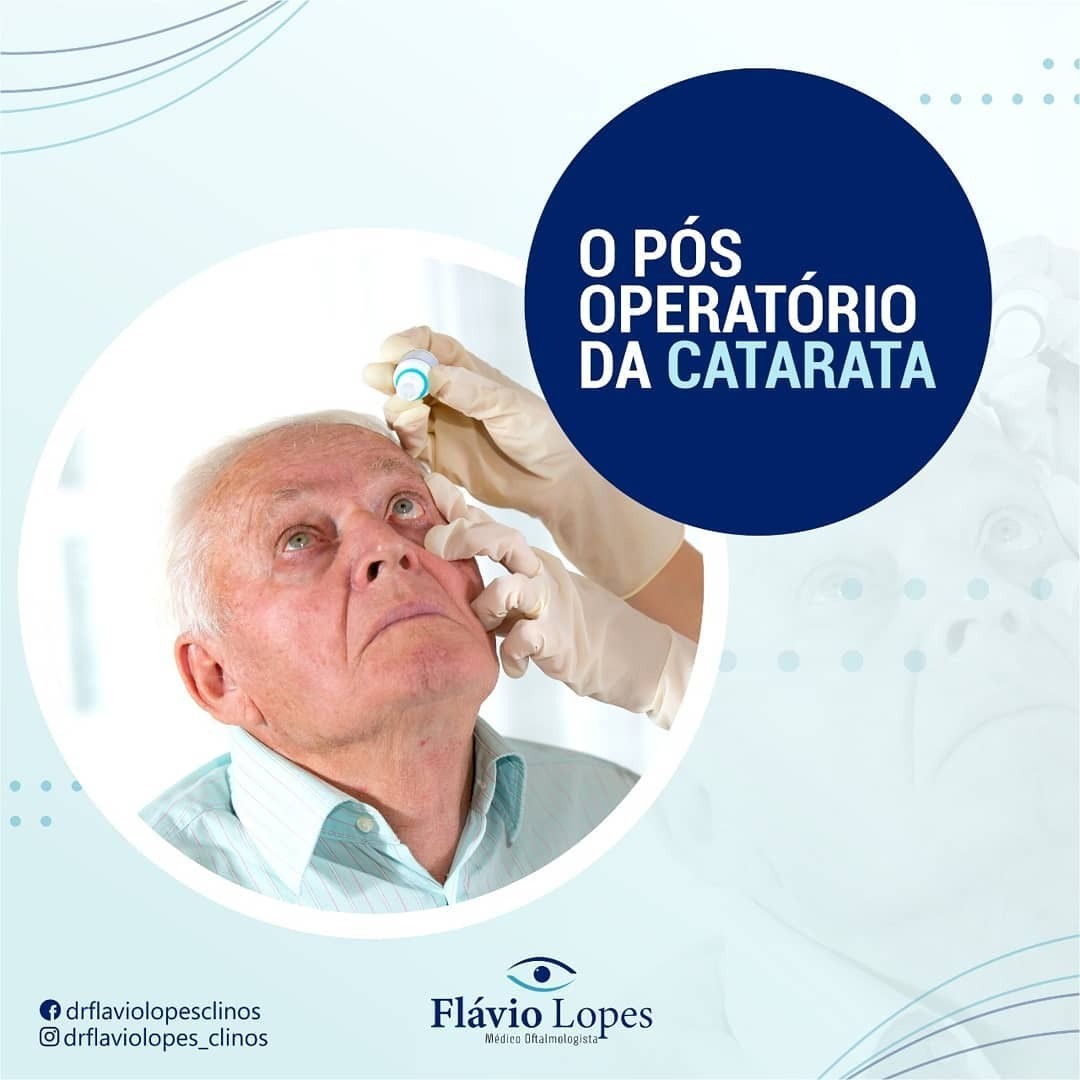 Existem casos de catarata na sua família? .