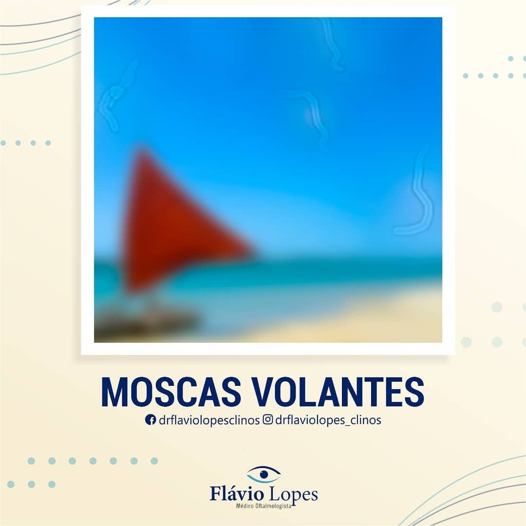 Você enxerga manchas flutuando na visão?