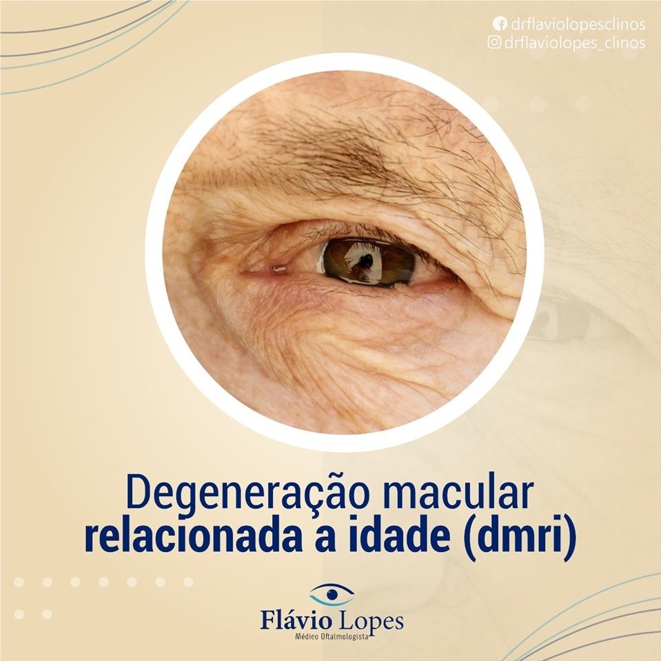 Trate da saúde dos seus olhos!
