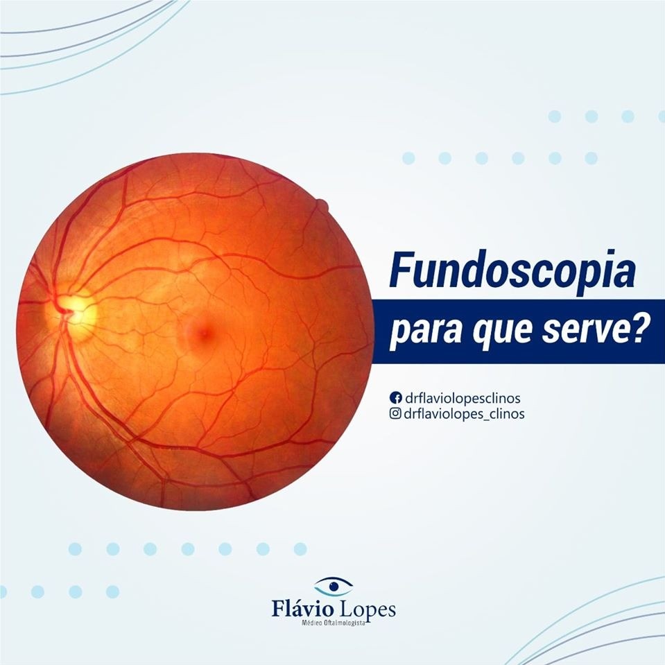Fundoscopia para que serve?