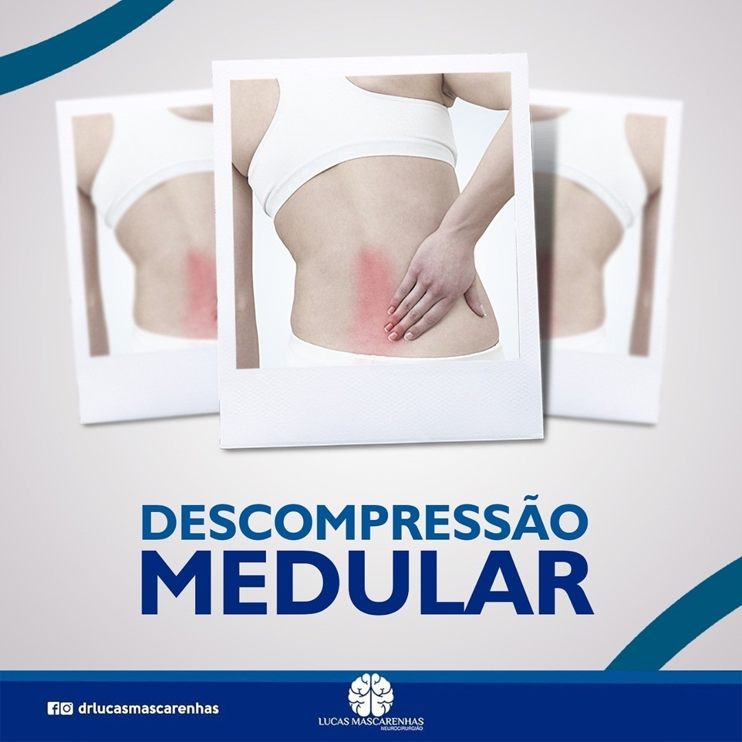 A descompressão medular