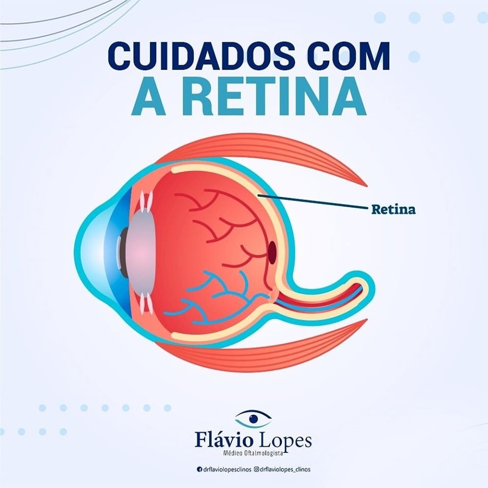 Você cuida bem dessa parte tão importante do seu olho?