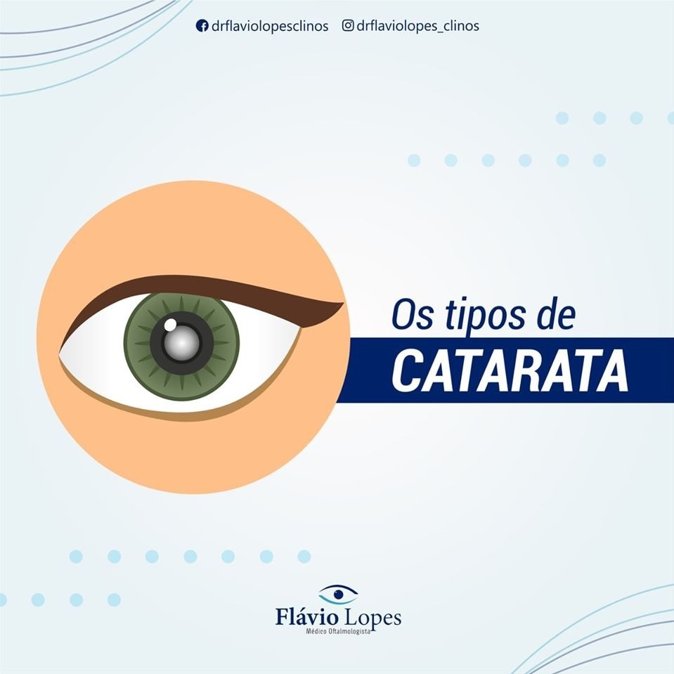 Você sabia que existe vários tipos de catarata?