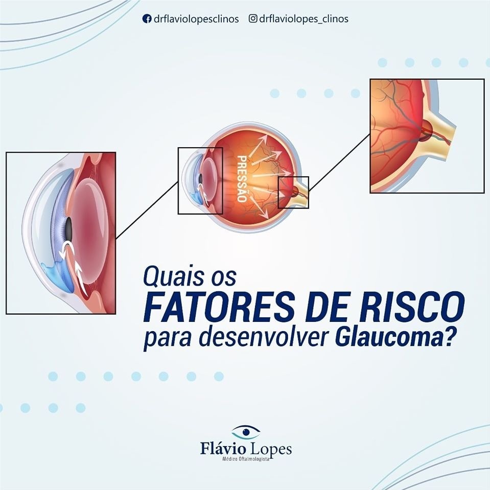  Existem fatores de risco para desenvolver o glaucoma: