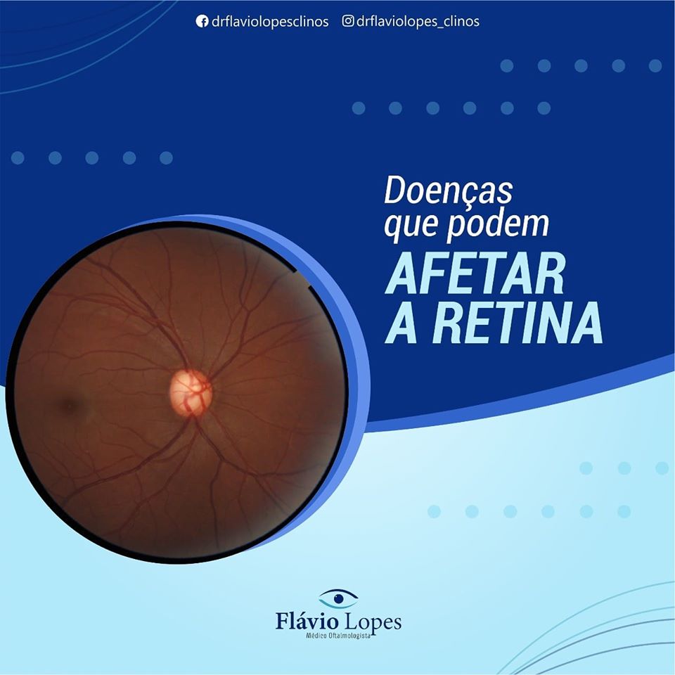 Cuide da sua visão! 