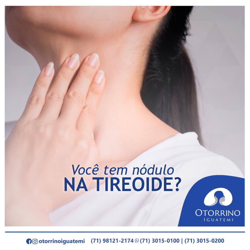 Nódulos na tireoide