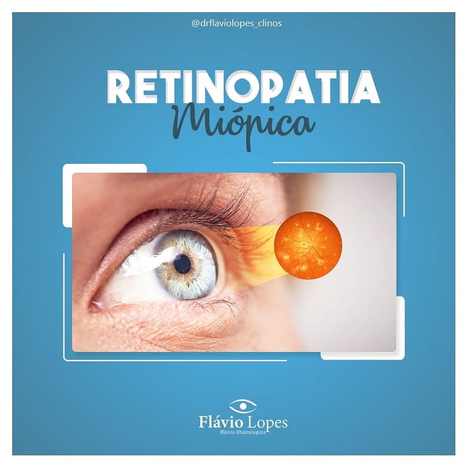 Qual seu grau de miopia?