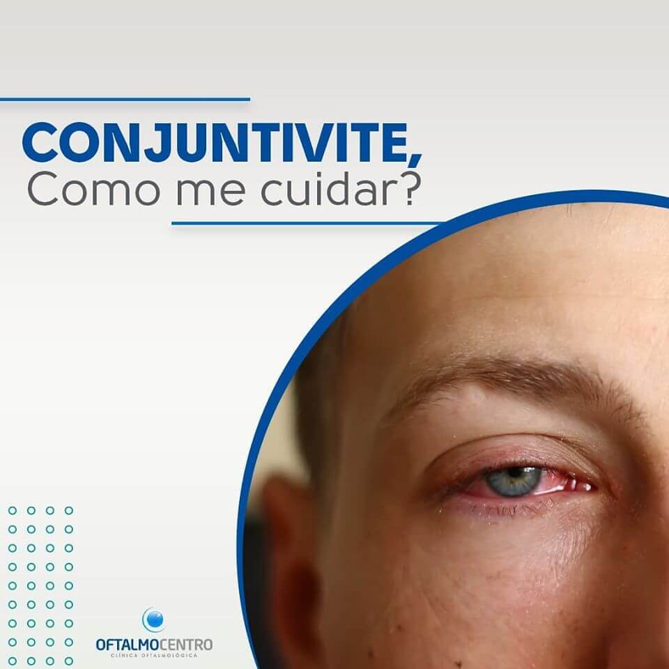 Como me cuidar da Conjuntivite?