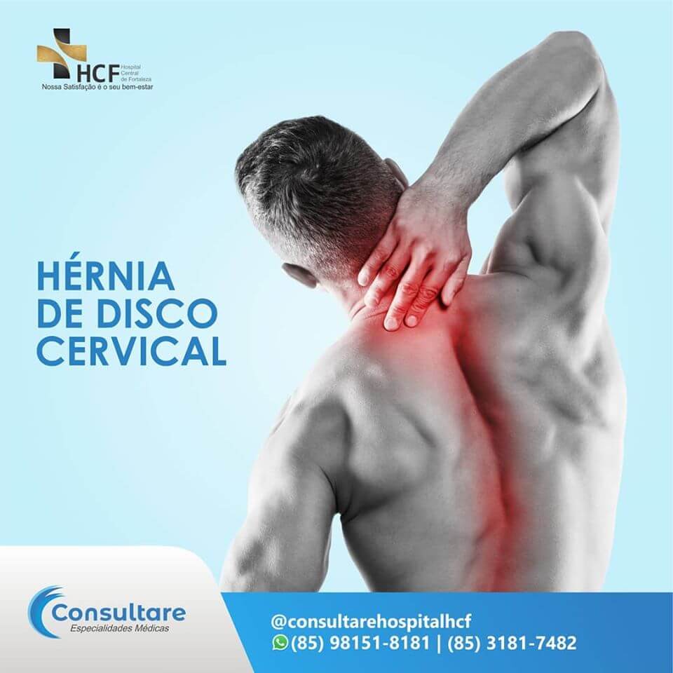 Hérnia de disco cervical