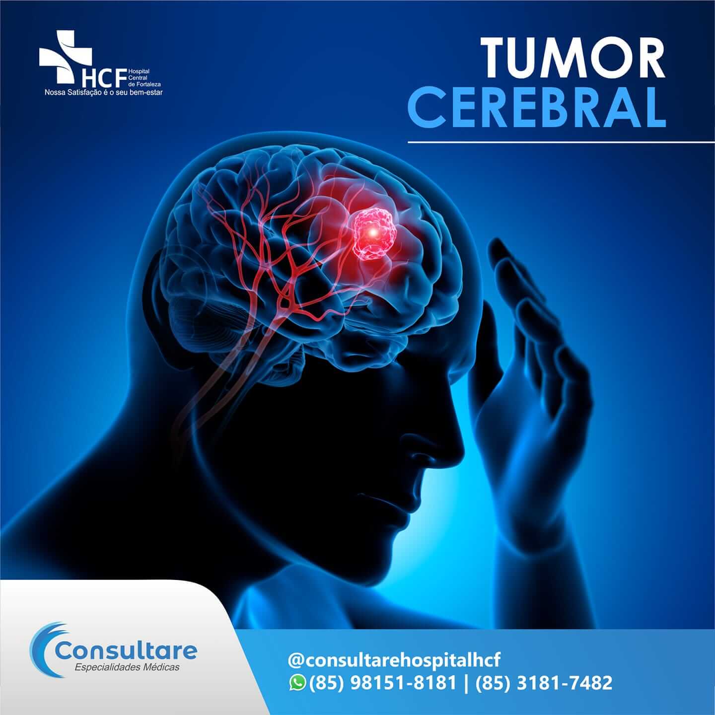 Tumor Cerebral